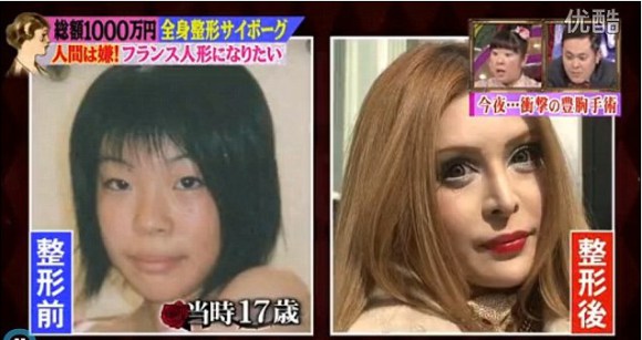عمليات التجميل لفتاة يابانية