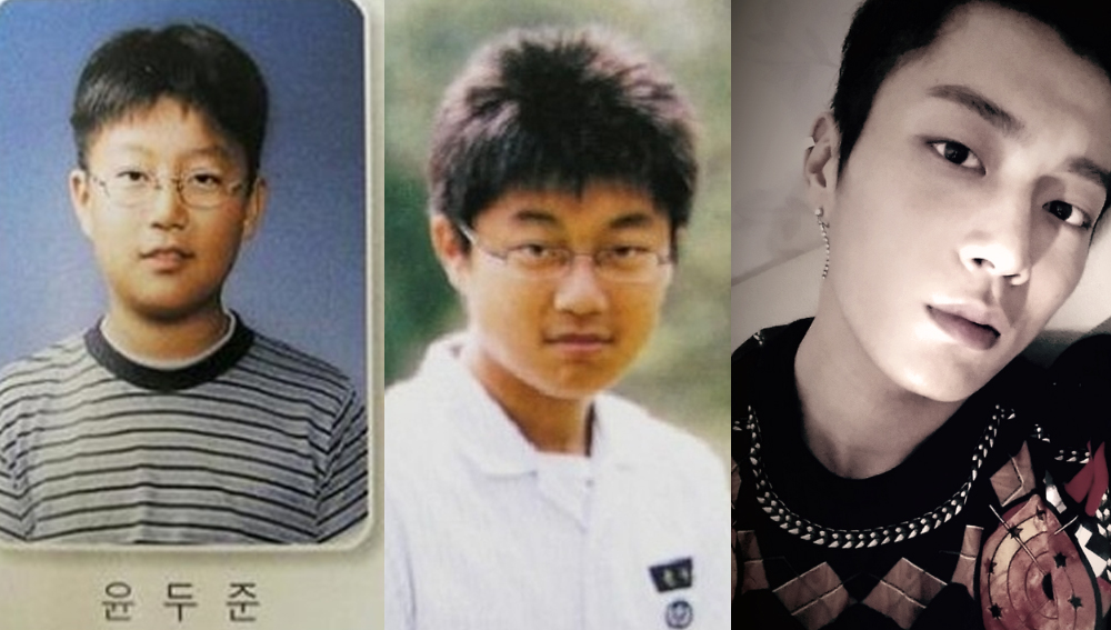 Doojoon before & after