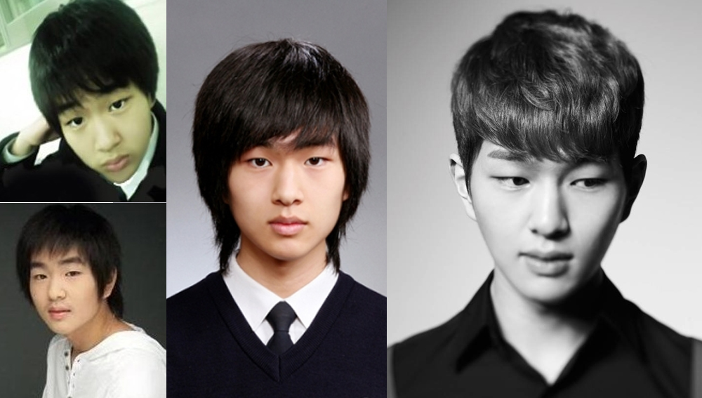 Onew before & after