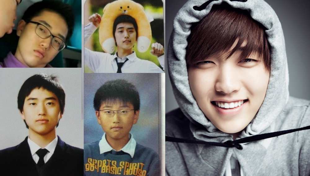 Sandeul before & after