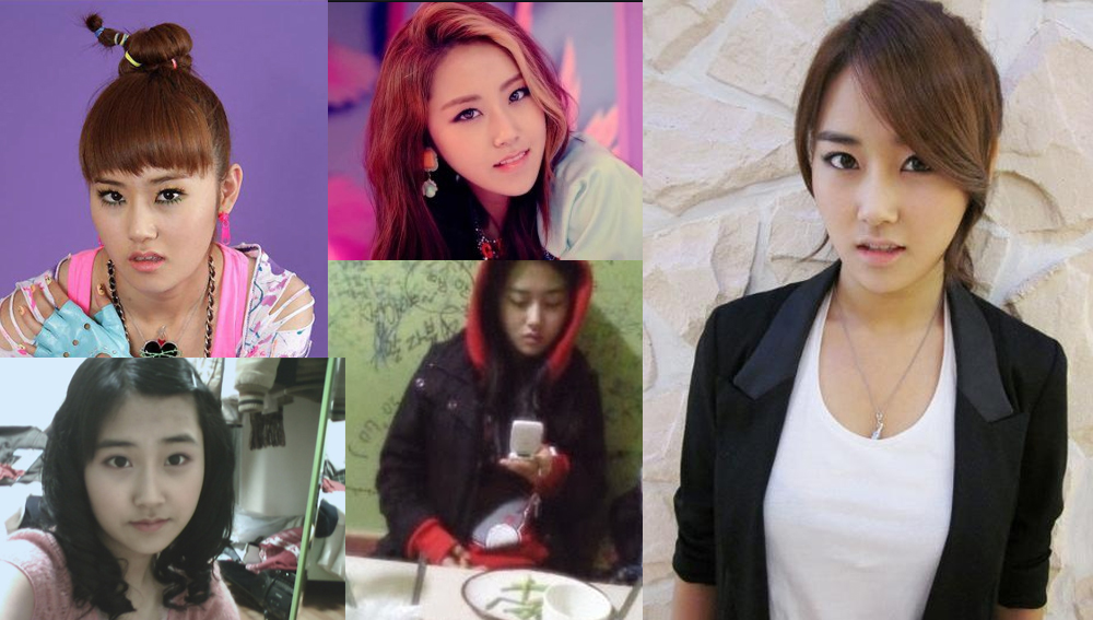 before & after gayoon