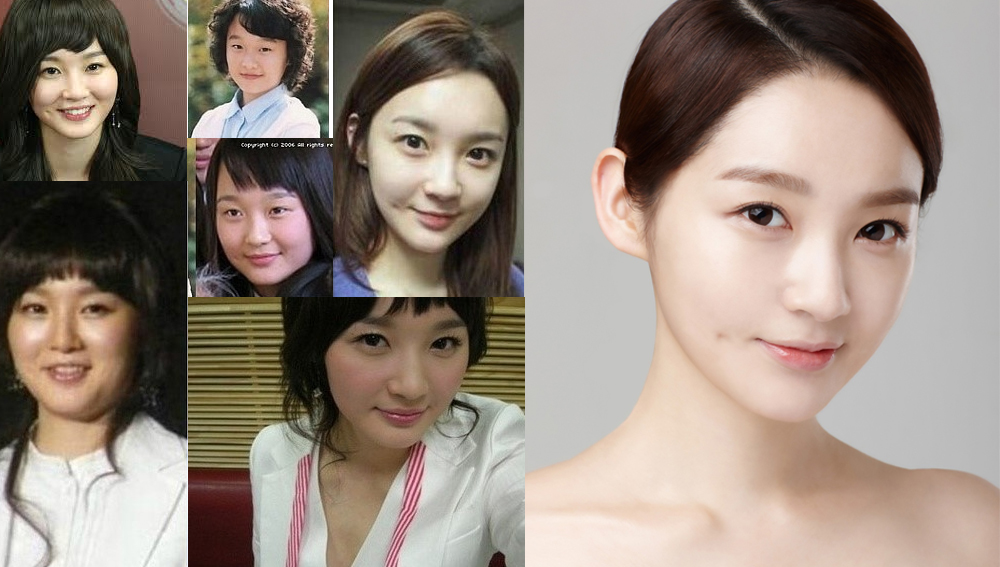 before & after kang min kyung