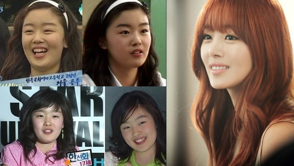 before & after sunhwa