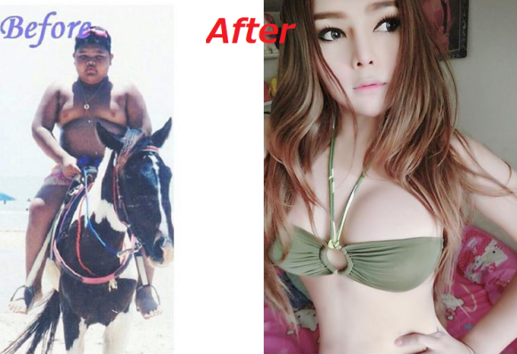 Thai boy before and after 1