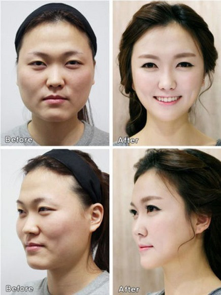 korean before & after 1