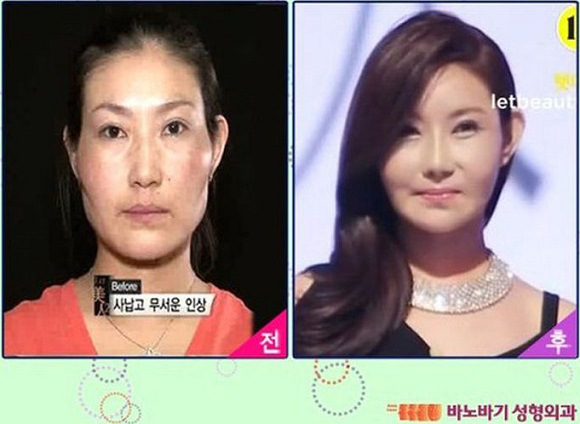 korean before & after 10