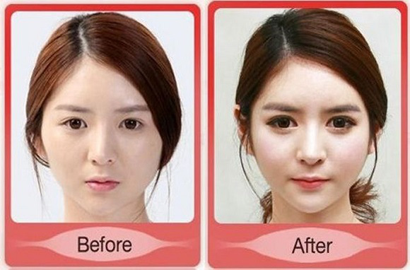 korean before & after 11