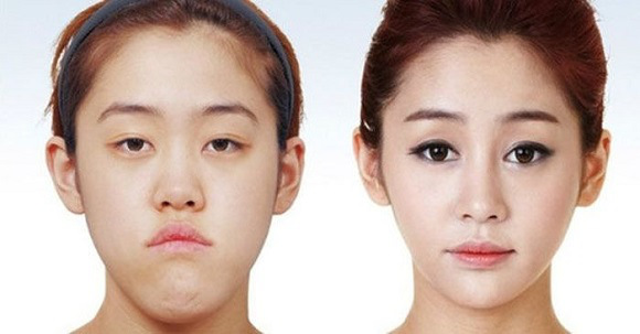 korean before & after 12