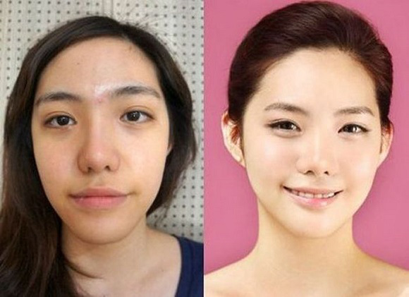 korean before & after 13