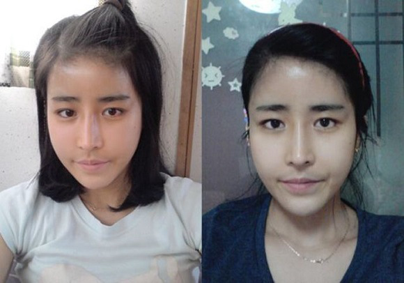 korean before & after 15