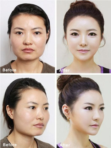 korean before & after 2