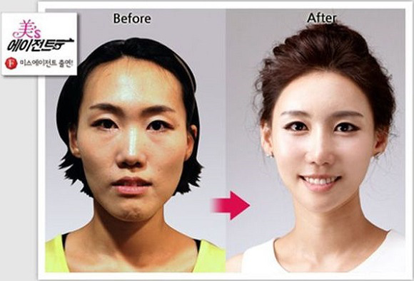 korean before & after 20
