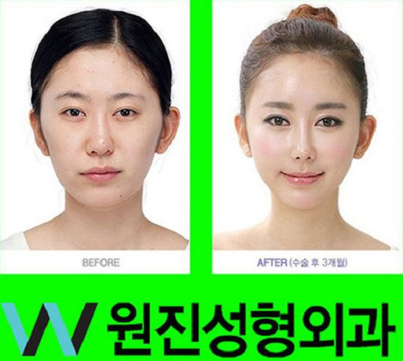 korean before & after 21