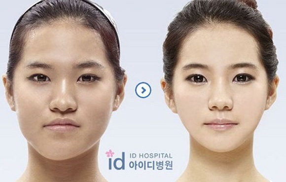 korean before & after 23