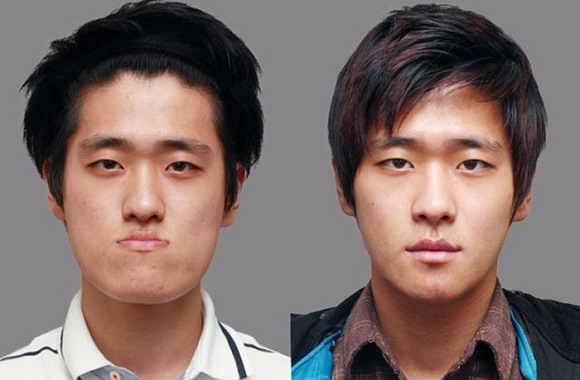korean before & after 25