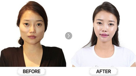 korean before & after 28