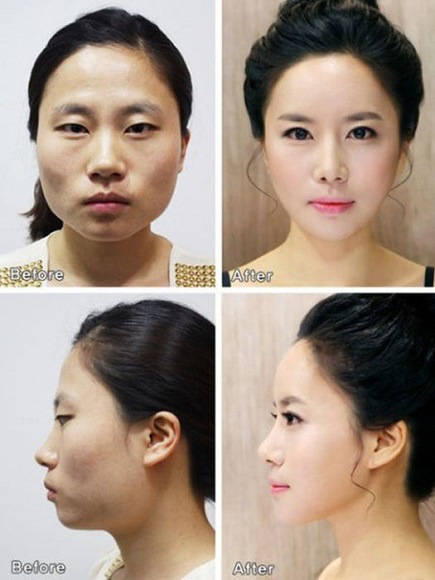 korean before & after 3