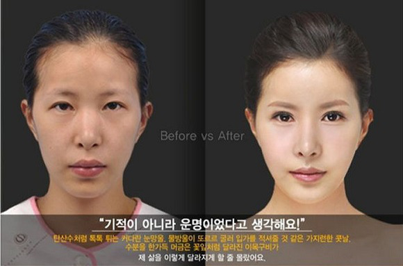 korean before & after 30