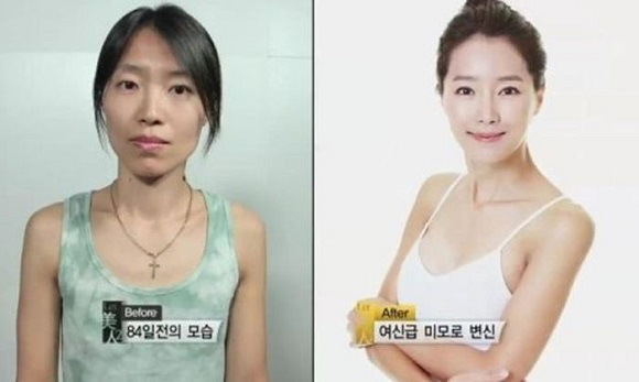 korean before & after 31