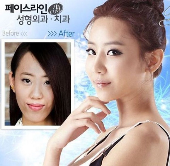 korean before & after 37