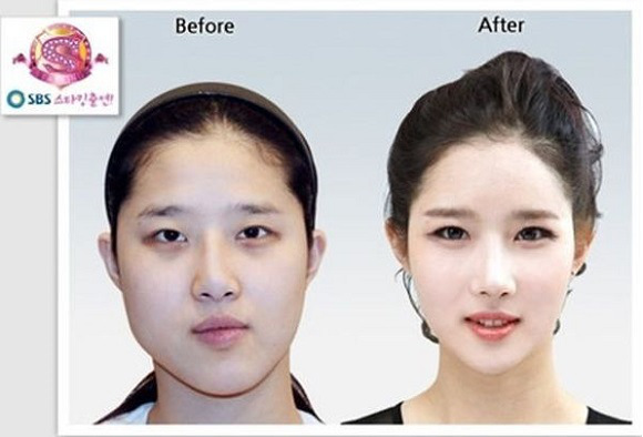 korean before & after 38