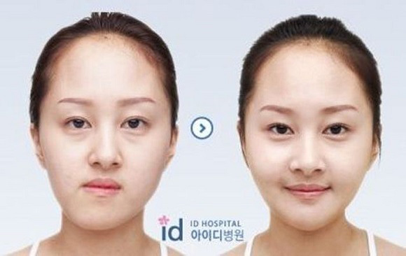 korean before & after 39