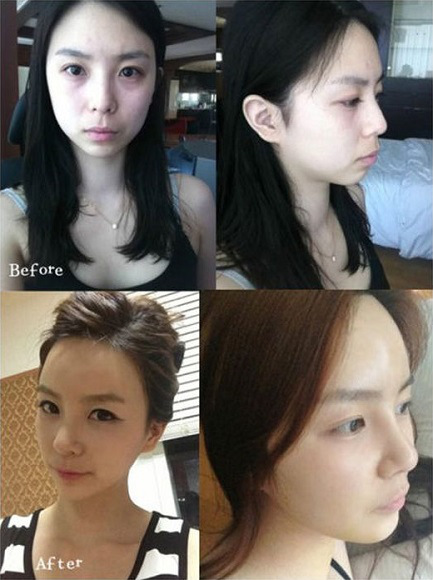 korean before & after 4