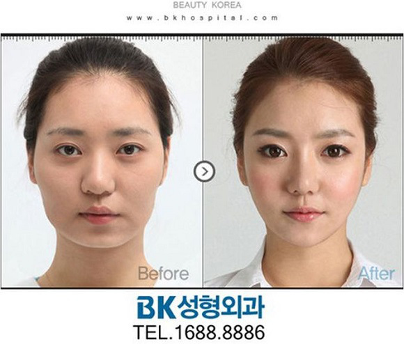korean before & after 42