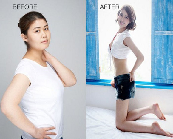 korean before & after 43