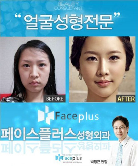 korean before & after 5