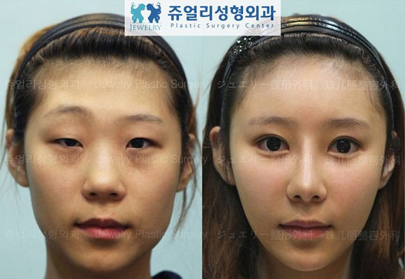 korean before & after 50