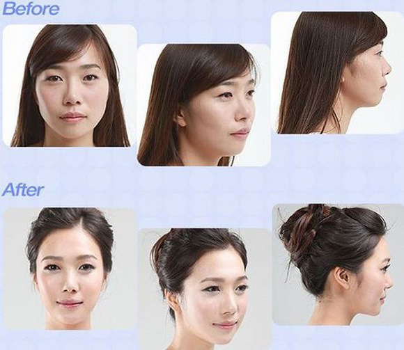 korean before & after 51