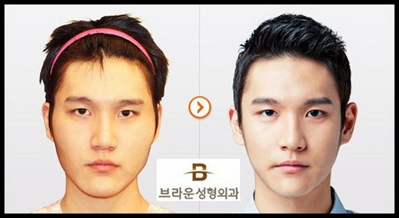 korean before & after 57