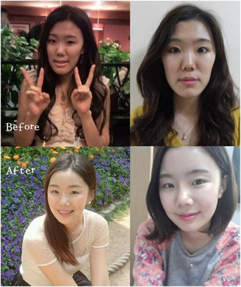 korean before & after 6