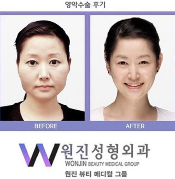 korean before & after 7