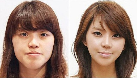 korean before & after 8