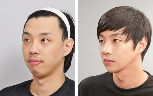 korean before & after 9